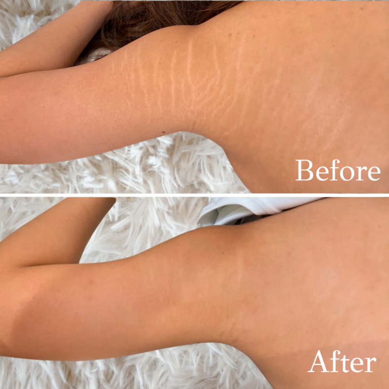 Anna-website-photos-1-768x768