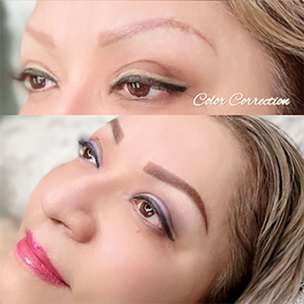 Brow Correction NYC And NJ