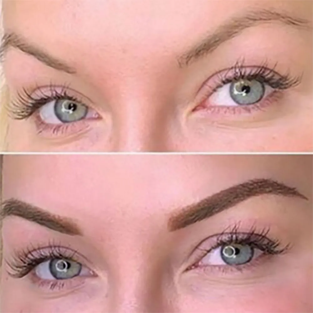 Brow Correction NYC And NJ