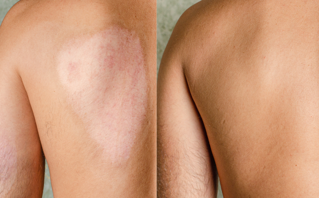 Scar-Camouflage-6-1024x637