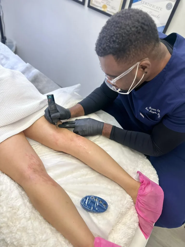 Scar-Stretch-Mark-Camouflage-In-NY-And-NYC-3