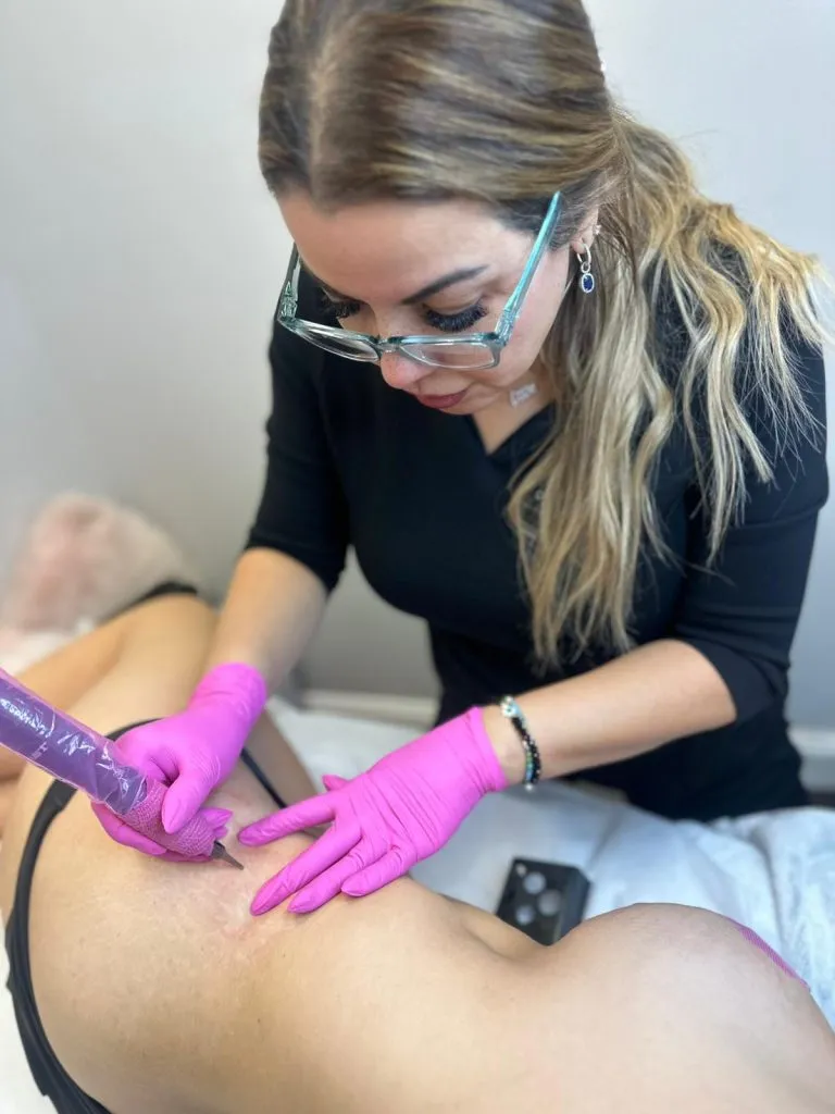 Scar-Stretch-Mark-Camouflage-In-NY-And-NYC-4-768x1024