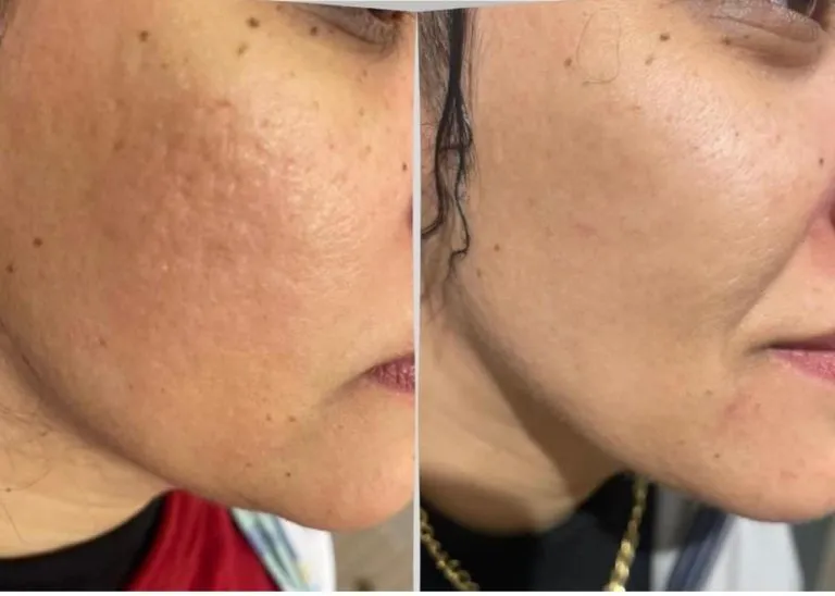 scar-camouflage-1-768x548