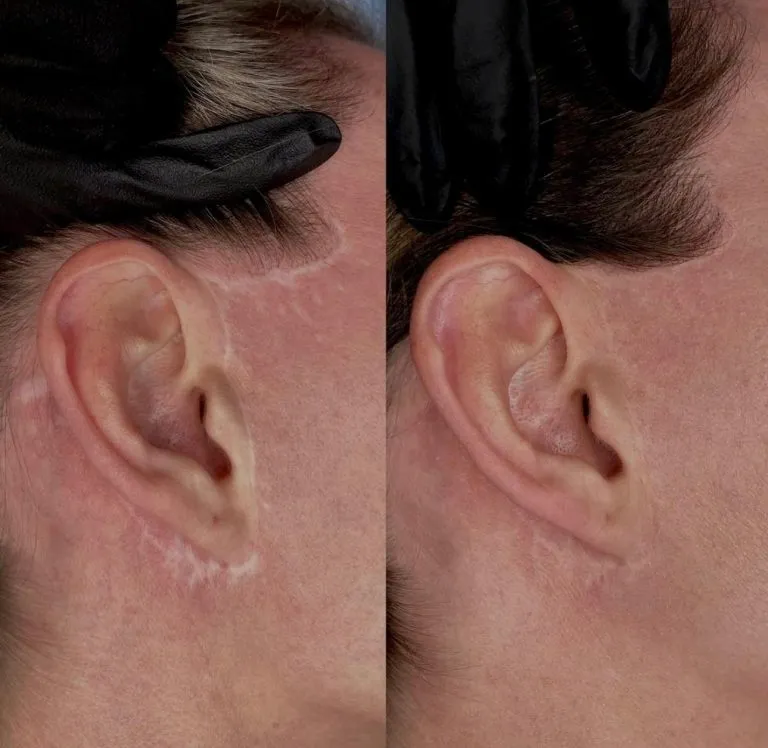 scar-camouflage3-768x748