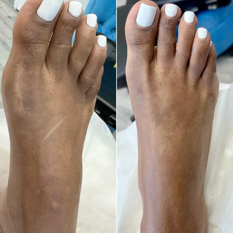 scar-camouflage4-768x768