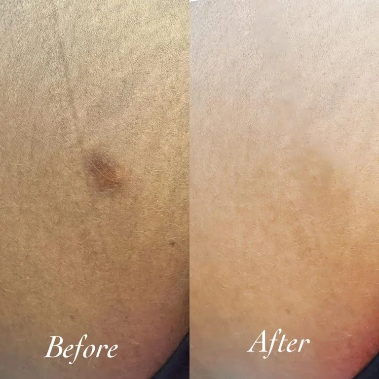 scar-camouflage5-768x768