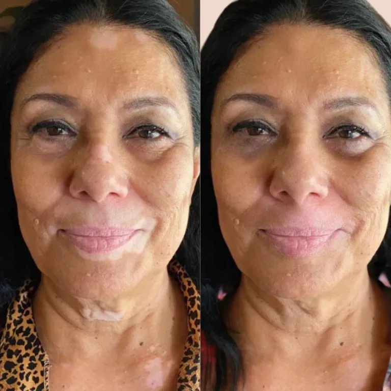 scar-camouflage6-768x768