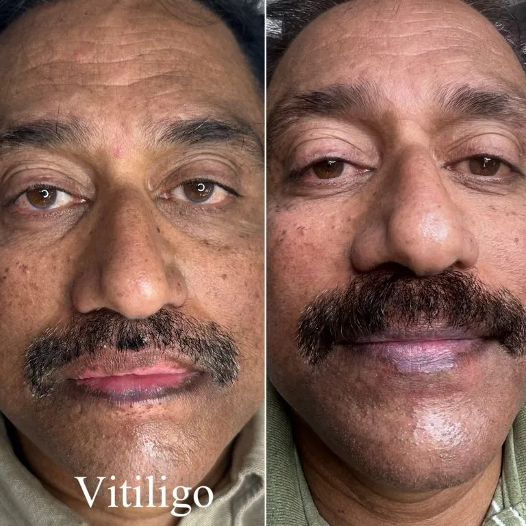 scar-camouflage9-768x768