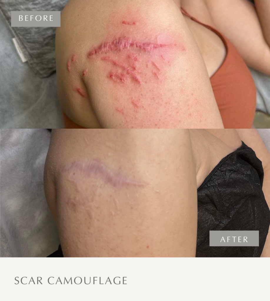 Scar Camouflage Frame 11