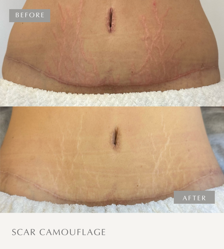 Scar Camouflage Frame 12