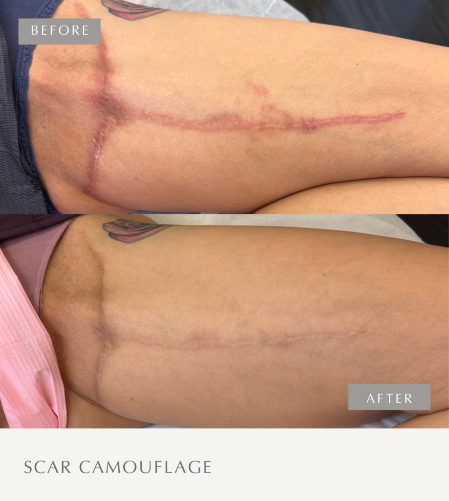 Scar Camouflage Frame 8