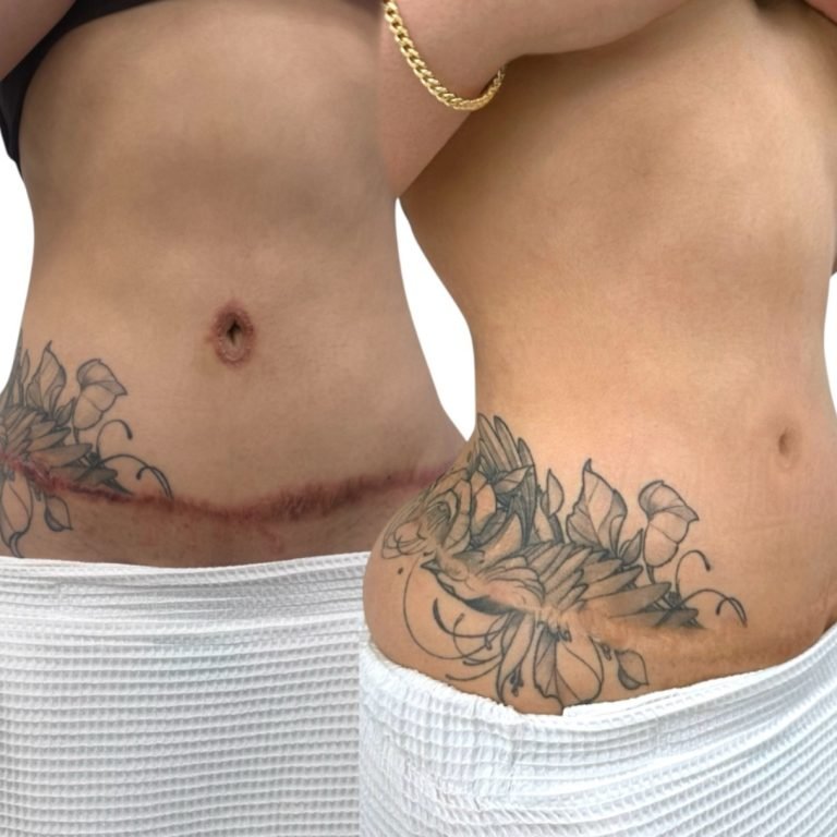 paramedical-tattooing-1